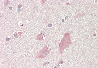 Immunohistochemical staining of NMNAT2 using anti-NMNAT2 (human), mAb (Nady-1) (Prod. No. AG-20A-0087) in human brain cortex tissue (10?g/ml). This antibody has been tested in immunohistochemistry, analyzed by an anatomic pathologist and valid