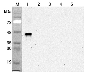 Western blot analysis using anti-Sirtuin 6 (human), mAb (S6R82-2) (Prod. No. AG-20A-0091) at 1:2'000 dilution.1: Human sirtuin 6 (His-tagged).2: Human sirtuin 1 (His-tagged).3: Human sirtuin 2 (His-tagged).4: Human sirtuin 5 (His-t