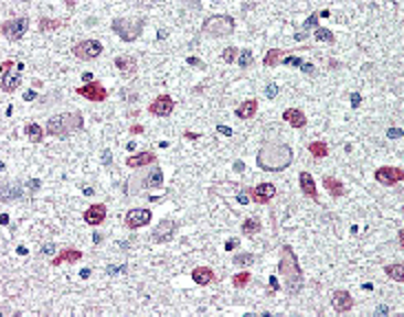 Immunohistochemical staining of FTO with anti-FTO (human), mAb (AG103) (Prod. No. AG-20A-0092) in brain, hypothalamus and paraventricular nucleus (5~10 ?g/ml). This antibody has been tested in immunohistochemistry, analyzed by an anatomic patholo