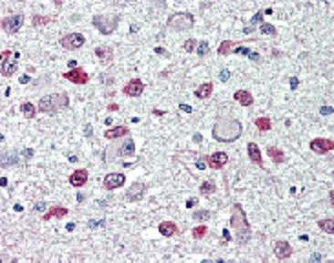 Immunohistochemical staining of FTO with anti-FTO (human), mAb (AG103) (Prod. No. AG-20A-0092) in brain, hypothalamus and paraventricular nucleus (5~10 microg/ml). This antibody has been tested in immunohistochemistry, analyzed by an anatomic patholo