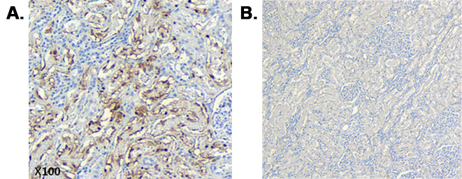 Immunohistochemical staining of CTRP6 using anti-CTRP6 (human), mAb (256-E) (Prod. No. AG-20A-0093) in human tissue. Method: A. Paraffin-embedded human kidney tissue, showing stained cell cytoplasm using anti-CTRP6 (human), mAb (256-E) at dil