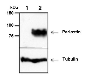 Mouse Periostin is detected by immunoblotting using anti-Periostin, mAb (Stiny-1) (Prod. No AG-20B-0033). Whole tissue extracts from mouse liver (lane 1) or mammary tumor (lane 2) were separated by SDS-PAGE under reducing conditions, transferred to