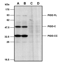 Mouse PIDD is detected in primary MEF cells using anti-PIDD (mouse), mAb (Lise-1) (Prod. N?AG-20B-0038). Method:: Cell extracts from mouse embryo fibroblasts (MEFs) either from WT (A-B) or  PIDD KO cells (C-D) were separated by SDS-PAGE under
