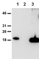 Mouse and human IL-38 is detected using anti-IL-38, mAb (Nhat-1) (AG-20B-0070).Method: Recombinant mouse IL-38 (AG-40B-0101) (lane 1), cell extracts from HEK 293 cells mock-transfected (lane 2) or transfected with human IL-38 (lane 3) were se