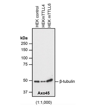 Figure 1: Immunoblot analysis of ?-tubulin protein glutamylation using anti-?-Tubulin, mAb (AXO45) (Prod. No. AG-20B-0085). Method: HEK-293T cells are grown in standard culture conditions, transfected with plasmids expressing the different glutamylases, TTLL4 and TTLL6 and are run on a 10% SDS-PAGE (specific protocol to separate ?- and ?-tubulin (Magiera & Janke, 2013)). The proteins are transferred to a nitrocellulose membrane and detected by standard immunoblot protocol using the AXO45 (1:1'000) in PBS containing 0.1% Tween-20 for washing steps and 2.5% fat free milk for antibody incubation. In all the cell extracts, AXO45 specifically detects ?-tubulin, with no cross-reactivity to ?-tubulin. Glutamylation added by either TTLL4 or TTLL6 appears to not affect this detection. Picture courtesy of Sudarshan Gadadhar, Shreyangi Chakraborty, Mariya Genova and Carsten Janke, Institut Curie, Orsay.