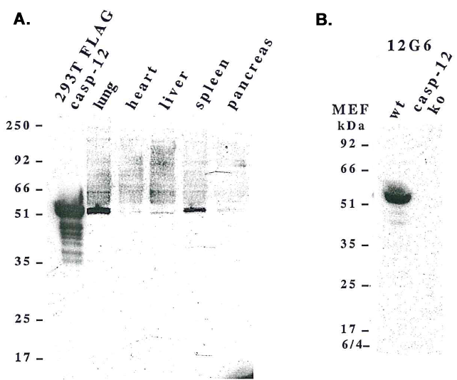 Western blot analysis using anti-caspase-12 (mouse), mAb (12G6) (Prod. No. AG-20T-0141) detecting, A) endogenous caspase-12 in mouse lung, liver, spleen and pancreas, and B) pro-caspase-12 in mouse MEF?s.