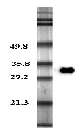 Western blot analysis in human plasma using anti-Adiponectin (human), pAb (Prod. No. AG-25A-0003) at 0.2?g/ml concentration.