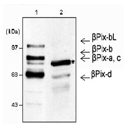 Western blot analysis using anti-beta-Pix (mouse), pAb (Prod. No. AG-25A-0006).
1: Mouse brain lysates (30?g).
2: NIH3T3 whole cell lysates (30?g).
* beta-Pix is a major isoform in NIH3T3 lysates, while other beta-Pix