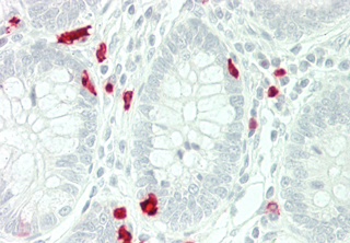 Immunohistochemical staining of RELM-beta using anti-RELM-beta (human), pAb (Prod. No. AG-25A-0012) in human small intestine tissue (5?g/ml). This antibody has been tested in immunohistochemistry, analyzed by an anatomic pathologist and va