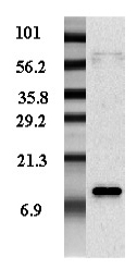 Western blot analysis of adipocyte-conditioned medium from human male and female with different expression levels using anti-Resistin (human), pAb (Prod. No. AG-25A-0013).