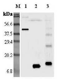 Western blot analysis using anti-Resistin (mouse), pAb (Prod. No. AG-25A-0014) at 1:5'000 dilution.
1: Mouse Resistin Fc-protein.
2: Mouse Resistin.
3: Mouse Resistin (His-tagged).
