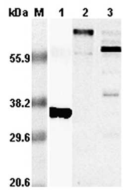 Western blot analysis using anti-RANKL (human), pAb (Prod. No. AG-25A-0016) at 1:5,000 dilution.
1. Recombinant hRANKL (His-tagged).
2. Human RANKL (GST-tagged).>br />
3. Con-A activated human T lymphocytes lysate.