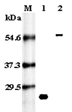 Western blot analysis using anti-RANK (human), pAb (Prod. No. AG-25A-0021) at 1:5,000 dilution.
1: Recombinant human RANK (His-tagged).
2: Human RANK (Fc protein).