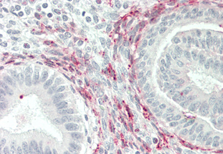 Immunohistochemical staining of GITRL using anti-GITRL (human), pAb (Prod. No. AG-25A-0023) in human uterus tissue (5?g/ml). This antibody has been tested in immunohistochemistry, analyzed by an anatomic pathologist and validated for use in IH