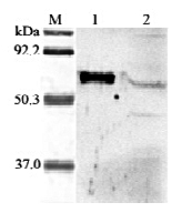 Western blot analysis of human ANGPTL6 using anti-ANGPTL6 (Prod. No. AG-25A-0030) at 1:2,000 dilution.
1. Recombinant human ANGPTL6 (FLAG?-tagged).
2. HepG2 cells lysate.