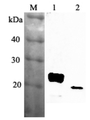 Western blot analysis using anti-RBP4 (mouse), pAb (Prod. No. AG-25A-0036) at 1:2'000 dilution.
1: Mouse RBP4 (His-tagged).
2: Mouse serum (ob/ob) (2?l).