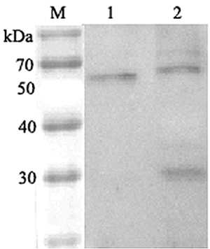 Western blot analysis using anti-ANGPTL6 (human), pAb (Prod. No. AG-25A-0037) at 1:2'000 dilution.
1: Human ANGPTL6 (FLAG?-tagged).
2: HepG2 cell lysate.