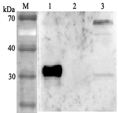 Western blot analysis using anti-ANGPTL4 (human), pAb (Prod. No. AG-25A-0038) at 1:2'000 dilution.
1: Human ANGPTL4 (FLAG?-tagged).
2: Human ANGPTL6 (FLAG?-tagged).
3: HepG2 cell lysate.