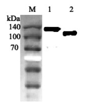 Western blot analysis using anti-ACE2 (human), pAb (Prod. No. AG-25A-0042) at 1:2'000 dilution.
1: Human ACE2 Fc-protein.
2: Human ACE2 (ED) (FLAG?-tagged).