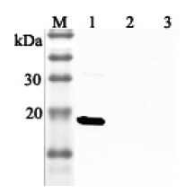 Western blot analysis using anti-IL-33 (human), pAb (Prod. No. AG-25A-0045) at 1:2'000 dilution.
1: Human IL-33 (His-tagged).
2: Unrelated protein (His-tagged) (negative control).
2: Human single chain IL-23 (FLAG?-tagged).