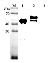 Western blot analysis using anti-Vaspin (human), pAb (Prod. No. AG-25A-0048) at 1:2'000 dilution.
1: Human Vaspin (His-tagged).
2: Human Vaspin (FLAG?-tagged).
3: Mouse IL-33 (His-tagged) (negative control).