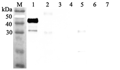 Western blot analysis using anti-ANGPTL7 (human), pAb (Prod. No. AG-25A-0050) at 1:2'000 dilution.
1: Human ANGPTL7 (FLAG?-tagged).
2: Human ANGPTL3 (FLAG?-tagged).
3: Human ANGPTL6 (FLAG?-tagged).
