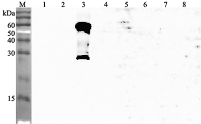 Western blot analysis using anti-ANGPTL3 (human), pAb (Prod. No. AG-25A-0052) at 1:4'000 dilution.
1: Human ANGPTL1 (FLAG?-tagged).
2: Human ANGPTL2 (FLAG?-tagged).
3: Human ANGPTL3 (FLAG?-tagged).