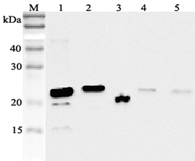 Western blot analysis using anti-RBP4 (human), pAb (Prod. No. AG-25A-0053) at 1:2'000 dilution.
1: Human RBP4 (His-tagged).
2: Human RBP4 (FLAG?-tagged).
3: Human serum (2?l).
4: Mouse RBP4 (FLAG?-tagged).<