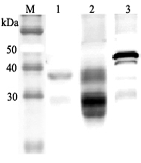 Western blot analysis using anti-Clusterin (mouse), pAb (Prod. No. AG-25A-0054) at 1:2'000 dilution.
1: Mouse serum (2?l).
4: Mouse seminal plasma.
5: Mouse Clusterin (nuclear form) (His-tagged).
