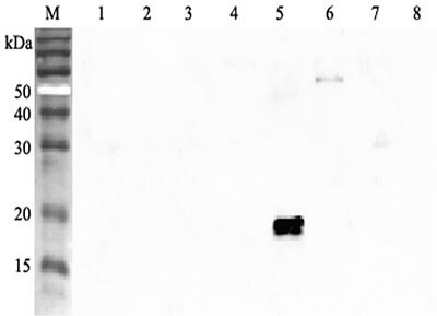 Western blot analysis using anti-ANGPTL4 (human), pAb (Prod. No. AG-25A-0055) at 1:2'000 dilution.
1: Human ANGPTL1 (FLAG?-tagged).
2: Human ANGPTL2 (FLAG?-tagged).
3: Human ANGPTL3 (FLAG?-tagged).