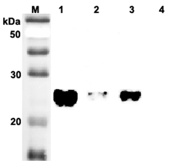 Western blot analysis of human tissue lysate using anti-TRB3 (human), pAb (Prod. No. AG-25A-0059) at 1:2,000 dilution.
1. Human spleen tissue lysate (10?g).
2. Human liver tissue lysate (10?g)
3. Human colon tissue lysate (10?g)