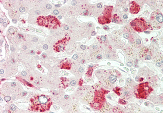 Immunohistochemical staining of ANGPTL3 using anti-ANGPTL3 (CCD) (human), pAb (Prod. No. AG-25A-0060) in human liver tissue (5?g/ml). This antibody has been tested in immunohistochemistry, analyzed by an anatomic pathologist and validated for