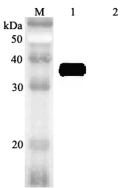 Western blot analysis using anti-MFAP4 (human), pAb (Prod. No. AG-25A-0061) at 1:2'000 dilution.
1: Human MFAP4 (FLAG?-tagged).
2: Mouse RBP4 (FLAG?-tagged) (negative control).