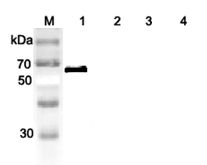 Western blot analysis of human DLL1 using anti-DLL1 (human), pAb (Prod. No. AG-25A-0062) at 1:2,000 dilution.
1. Recombinant human DLL1 (FLAG?-tagged).
2. Recombinant human DLL4 (Fc protein) (Negative control).
3. Recombinant