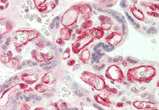 Immunohistochemical staining of ANGPTL3 using anti-ANGPTL3 (FLD) (human), pAb (Prod. No. AG-25A-0064) in human placenta tissue (5?g/ml). This antibody has been tested in immunohistochemistry, analyzed by an anatomic pathologist and validated f