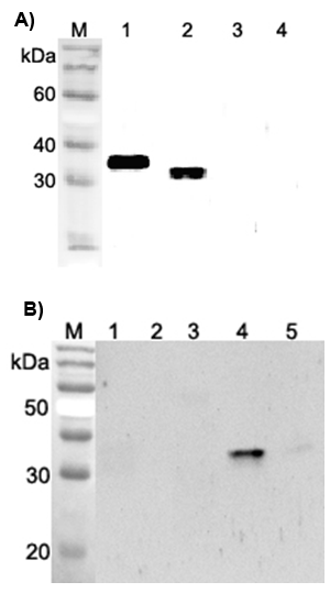 Western blot analysis using anti-ANGPTL4 (FLD) (human), pAb (Prod. No. AG-25A-0065) at 1:2'000 dilution.
A)
1: Human ANGPTL4 (FLD) (FLAG?-tagged).
2: Human ANGPTL4 (FLAG?-tagged).
3: Human ANGPTL4 (CCD) (FLAG<