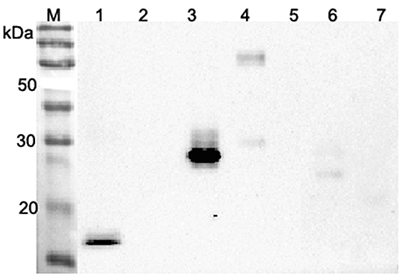 Western blot analysis using anti-ANGPTL4 (CCD) (human), pAb (Prod. No. AG-25A-0066) at 1:2'000 dilution.
1: Human ANGPTL4 (CDD) (FLAG?-tagged).
2: Human ANGPTL4 (FLAG?-tagged).
3: Human ANGPTL3 (CCD) (FLAG?