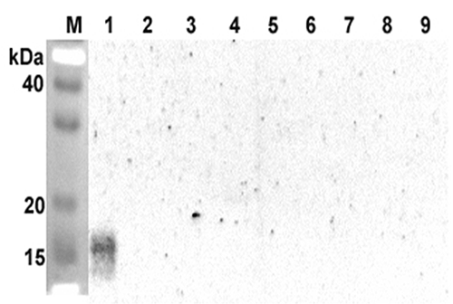 Western blot analysis using anti-ANGPTL5 (CCD) (human), pAb (Prod. No. AG-25A-0069) at 1:2'000 dilution.
1: Human ANGPTL5 (CCD) (FLAG?-tagged).
2: Human ANGPTL5 (FLD) (FLAG?-tagged).
3: Human ANGPTL2 (CCD) (FLAG