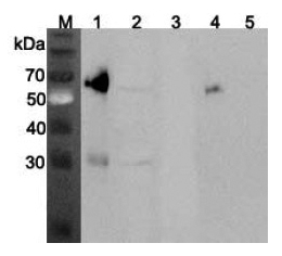 Western blot analysis using anti-ANGPTL3 (mouse), pAb (Prod. No. AG-25A-0070) at 1:2'000 dilution.
1: Mouse ANGPTL3 (FLAG?-tagged) (40ng).
2: Mouse liver cell lysate (Balb/c mouse, 150?g).
3: Mouse ANGPTL4 (FLAG?