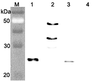 Western blot analysis of human FGF21 using anti-FGF-21 (human), pAb (Prod. No. AG-25A-0074) at 1:4,000 dilution. 1. Recombinant human FGF21 (FLAG-tagged). 2. Recombinant human FGF21 (Fc protein). 3. Recombinant human FGF21 (His-tagged).