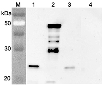 Western blot analysis using anti-FGF-21 (mouse), pAb (Prod. No. AG-25A-0076) at 1:4'000 dilution.
1: Mouse FGF-21 (FLAG?-tagged).
2: Mouse FGF-21 Fc-protein.
3: Human FGF-21 (FLAG?-tagged).
4: Mouse Nampt (FLA
