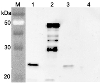 Western blot analysis using anti-FGF-21 (mouse), pAb (Prod. No. AG-25A-0076) at 1:4000 dilution. 1: Mouse FGF-21 (FLAG®-tagged). 2: Mouse FGF-21 Fc-protein. 3: Human FGF-21 (FLAG®-tagged). 4: Mouse Nampt (FLA