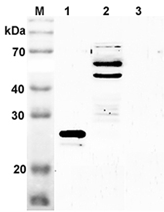 Western blot analysis using anti-SENP2 (mouse), pAb (Prod. No. AG-25A-0078) at 1:2'000 dilution.
1: Mouse SENP2 (catalytic domain) (His-tagged).
2: Mouse brain cell lysate (Balb/c mouse, 70?g)
3: Mouse IDO (His-tagged) (negative contr