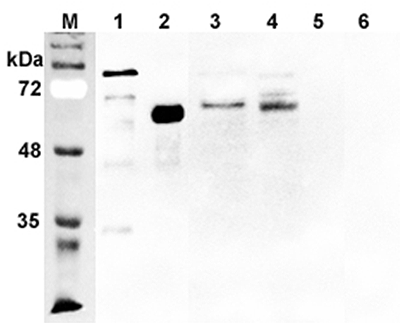 Western blot analysis using anti-DLL1 (human), pAb (Prod. No. AG-25A-0079) at 1:2'000 dilution.
1: Human DLL1 Fc-protein.
2: Human DLL1 (FLAG?-tagged)
3: Transfected human DLL1 cell lysate (HEK 293).
4: Primary human pan