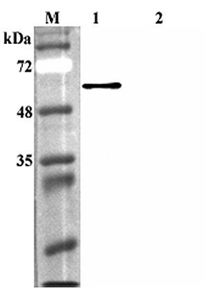 Western blot analysis using anti-FTO (human), pAb (Prod. No. AG-25A-0084) at 1:4'000 dilution.
1: Human FTO (His-tagged).
2: Human Sirtuin 1 (His-tagged) (negative control).