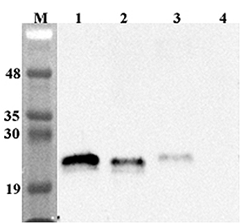 Western blot analysis using anti-Lipocalin-2 (human), pAb (Prod. No. AG-25A-0087) at 1:4'000 dilution.
1: Human Lipocalin-2 (FLAG?-tagged).
2: Mouse Lipocalin-2 (FLAG?-tagged).
3: Rat Lipocalin-2 (FLAG?-t
