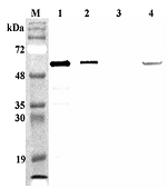 Western blot analysis of mouse FTO using anti-FTO (mouse), pAb (Prod. No. AG-25A-0089) at 1:4,000 dilution. 1. Recombinant mouse FTO (His-tagged) (100ng). 2. Recombinant human FTO (His-tagged) (100ng). 3. Recombinant hFGF19 (His-tagged)