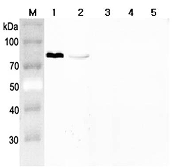 Western blot analysis using anti-Progranulin (mouse), pAb (Prod. No. AG-25A-0093) at 1:2'000 dilution.
1: Mouse Progranulin (FLAG?-tagged).
2: Human Progranulin (FLAG?-tagged).
3: Human Granulin C (FLAG?-