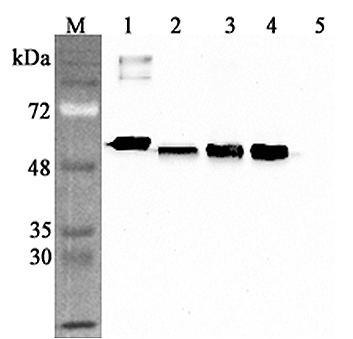 Western blot analysis using anti-Calreticulin (human), pAb (Prod. No. AG-25A-0094) at 1:4'000 dilution.
1: Human Calreticulin (his-tagged).
2: HEK 293T cell lysate (100?g).
3: HepG2 cell lysate (100?g).
4: THP1 cell lysate (1