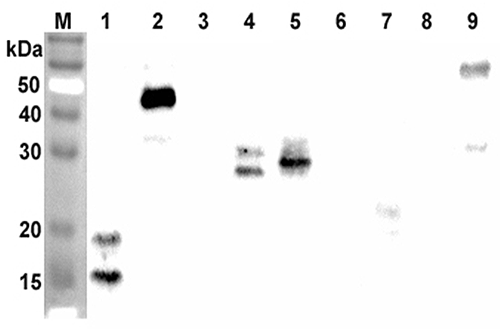 Western blot analysis using anti-ANGPTL7 (CCD) (human), pAb (Prod. No. AG-25A-0095) at 1:2'000 dilution.
1: Human ANGPTL7 (CCD) (FLAG?-tagged).
2: Human ANGPTL7 (FLAG?-tagged).
3: Human ANGPTL7 (FLD) (FLAG?